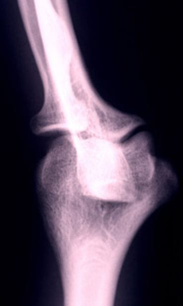 Lehtikuva/Marja Airio